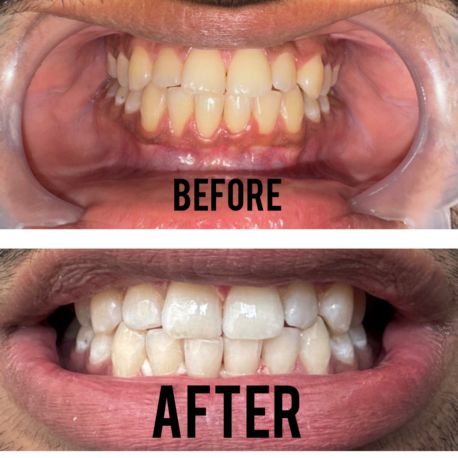 inshot_20250218_170207458